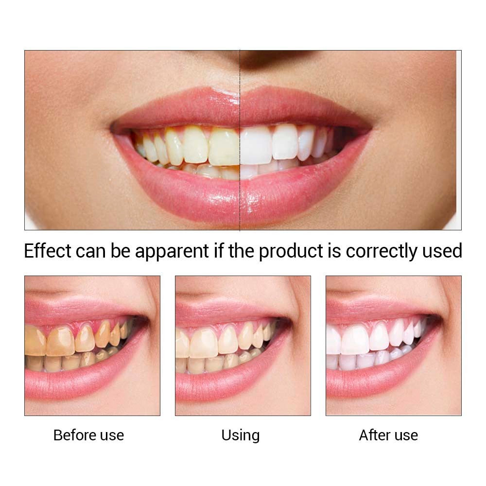 Teeth Whitening Oral Hygiene Cleaning Serum