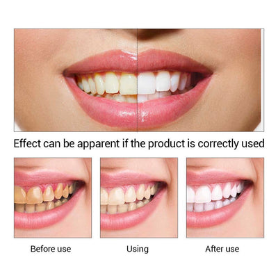 Teeth Whitening Oral Hygiene Cleaning Serum