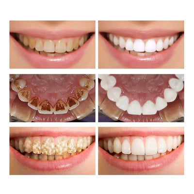 Teeth Whitening Oral Hygiene Cleaning Serum